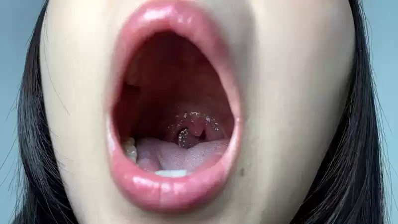 長い舌！みすずちゃんの口内観察