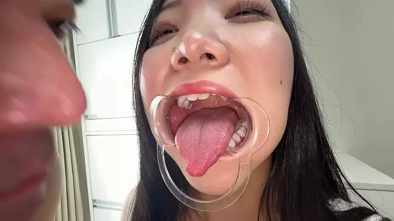【個人撮影】桃瀬まゆの舌ブラシで「汚舌苔」採取